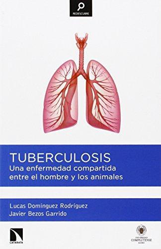 Tuberculosis Una Enfermedad Compartida Entre El Hombre Y Los Animales