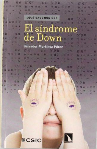 Sindrome De Down, El