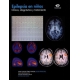 Epilepsia En Niños Clinica Diagnostico Y Tratamiento