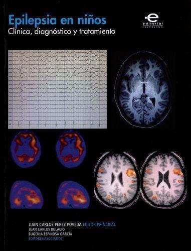 Epilepsia En Niños Clinica Diagnostico Y Tratamiento